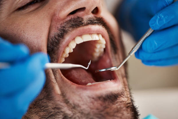 Trusted OK Emergency Dental Service Experts
